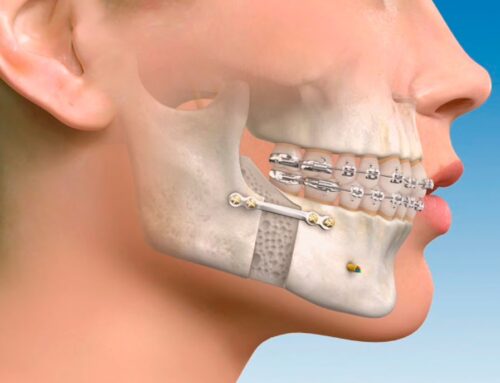 Cirugía maxilofacial en Castro Urdiales