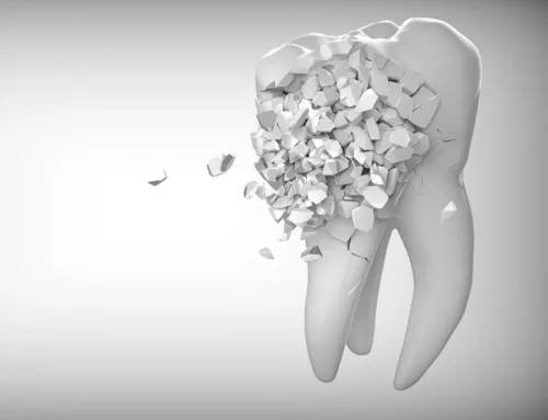 Dentista en Santander: ¿a qué edad es recomendable empezar la ortodoncia?