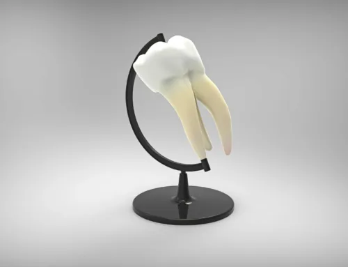 Implantes dentales en Santander: proceso, riesgos y resultados de este tratamiento