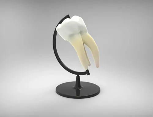 Tipos de carillas dentales en Santander: porcelana o composite