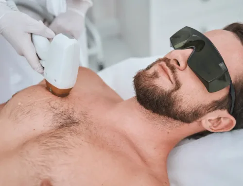 Depilación sin dolor para hombres en Astillero: qué zonas puedes tratar y cómo prepararte